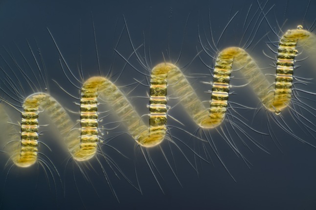 First place winner in the competition, this image depicts a colonial plankton organism, Chaetoceros debilis (marine diatom), magnified 250x by Wim van Egmond, of the Micropolitan Museum, Berkel en Rodenrijs, Zuid Holland, Netherlands. (Wim van Egmond) #